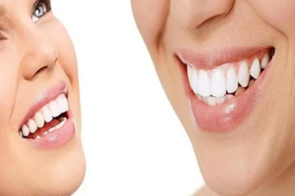 Brighten Your Smile with Modern Dental Procedures