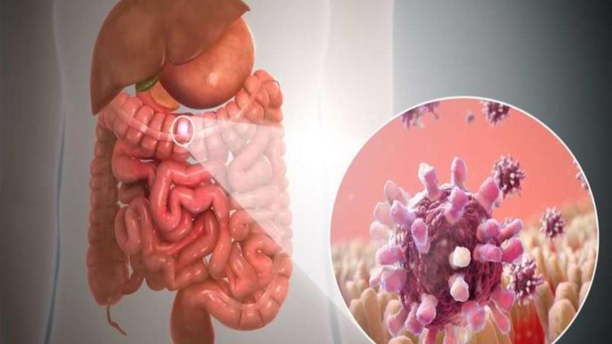 Modern Approaches to Treating Digestive Tract Cancers